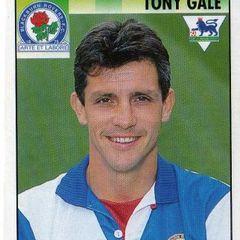 Tony Gale